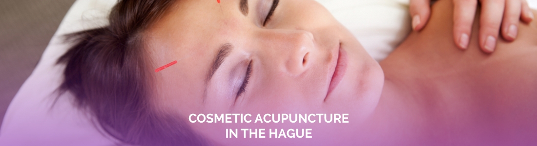 Cosmetic Acupuncture