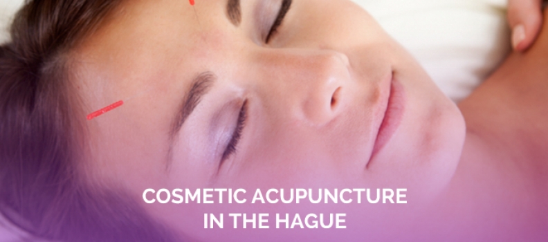 Cosmetic Acupuncture